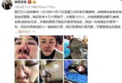 爆料博主毁容视频大全,毁容视频大全深度解析