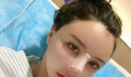整容爆料大全视频,整容爆料大全视频深度解析